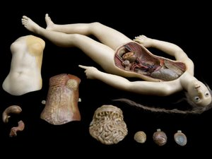 La Chirurgie au Musée La Chirurgie au Musée