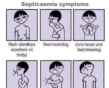 Septicemia