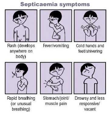 Septicemia