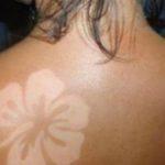 sunbathtattoo-la-dangereuse-tendance-des-coups-de-soleil-artistiques